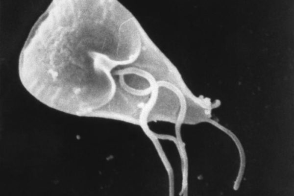 Caso Giardia a Sant'Agata Bolognese *AGGIORNATO*
