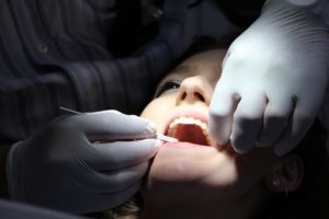 Catene odontoiatriche: fate attenzione